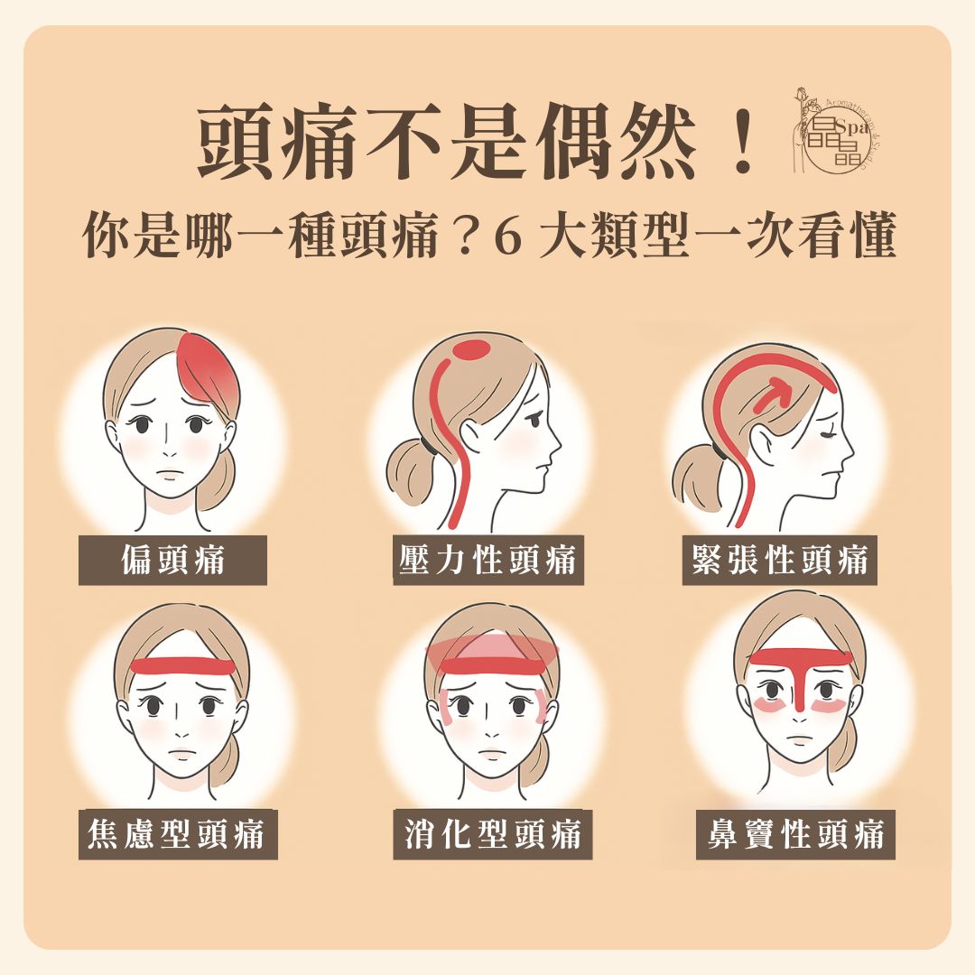 頭痛類型 頭痛 偏頭痛